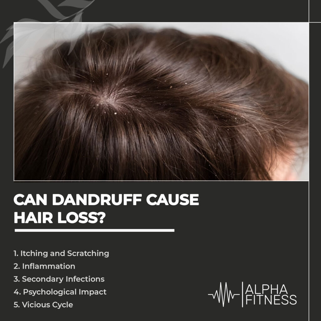 Can dandruff cause hair loss?