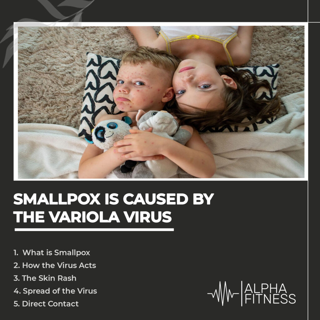 Smallpox is caused by the variola virus