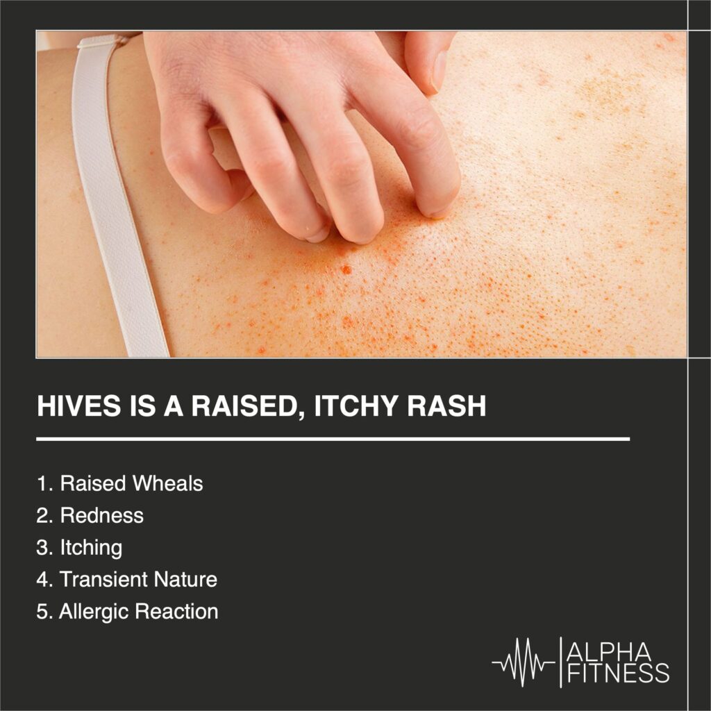 Hives is a raised, itchy rash - alphafitness.health