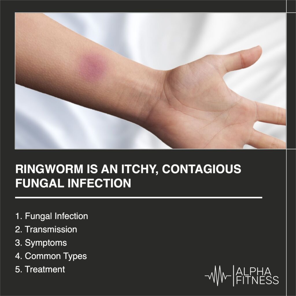 Ringworm is an itchy, contagious fungal infection - alphafitness.health
