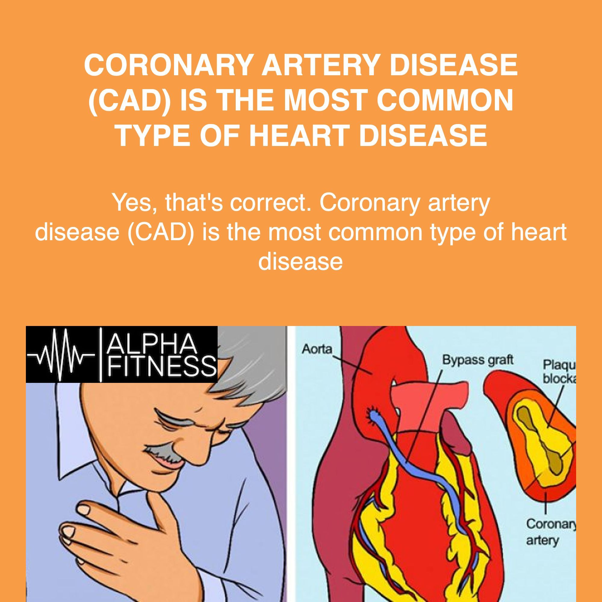 Coronary artery disease (CAD) is the most common type of heart disease