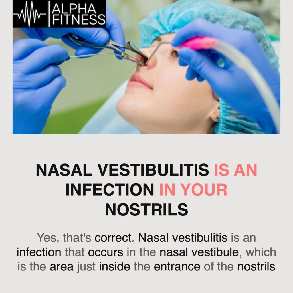 Nasal vestibulitis is an infection in your nostrils - alphafitness.health