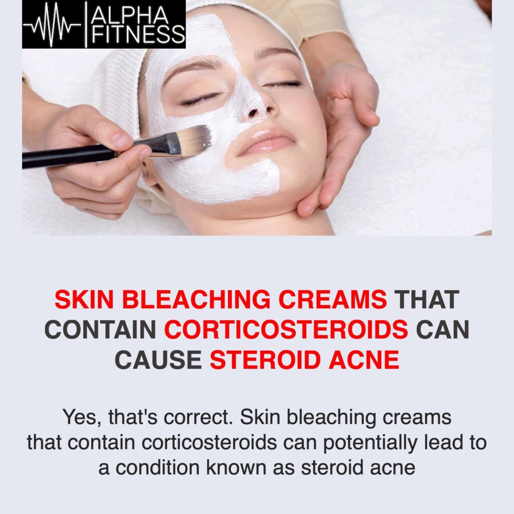 Skin bleaching creams that contain corticosteroids can cause steroid acne - alphafitness.health