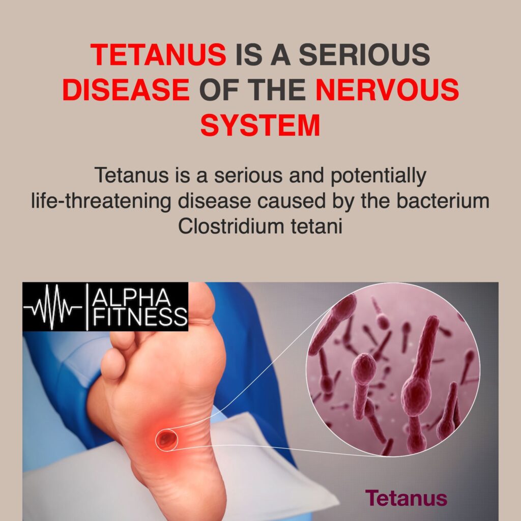 Tetanus is a serious disease of the nervous system - alphafitness.health